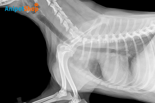 Chest X-rays